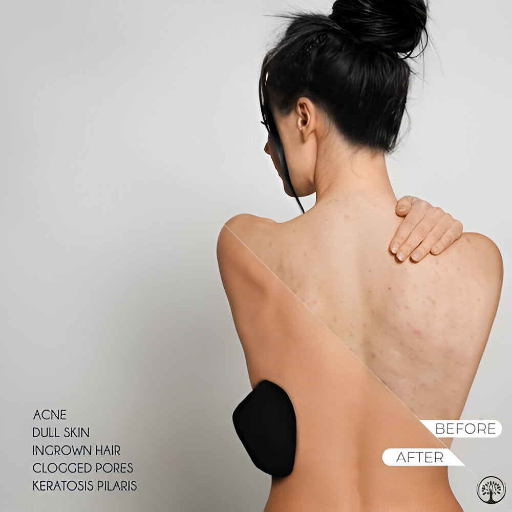 VIVENZA™- Skin Exfoliating Glove